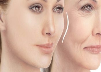 انجام لیزر co2 فرکشنال در مشهد