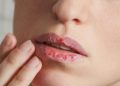 علت خشکی لب چیست و چگونه ترک لب را درمان کنیم؟