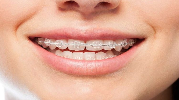 ارتودنسی کودکان