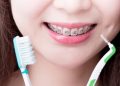 مسواک مخصوص ارتودنسی: معرفی انواع و نحوه استفاده از آن‌ها【سال1403】