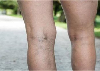 10 تا از بهترین دکتر واریس در رشت⭐【سال1403】✅