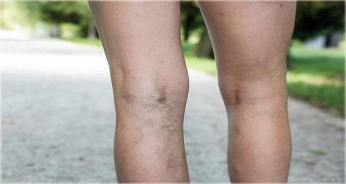 10 تا از بهترین دکتر واریس در رشت⭐【سال1403】✅